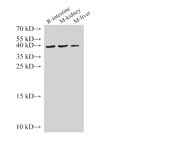 Western Blot analysis of Rat intestine, Mouse kidney and Mouse liver using AMACR Polyclonal Antibody at dilution of 1:1000.