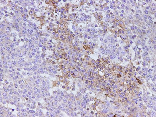 Immunohistochemistry of paraffin-embedded Human ovary using CD59 Polyclonal Antibody at dilution of 1:500