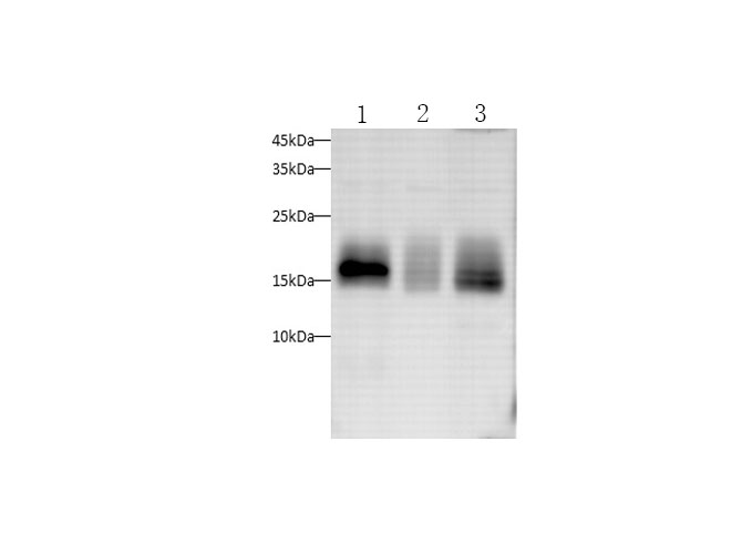 Western blot with CD59 Polyclonal antibody at dilution of 1:1000.lane 1:HUVEC whole cell lysate, lane 2:U87-MG whole cell lysate, lane 3:Hela whole cell lysate