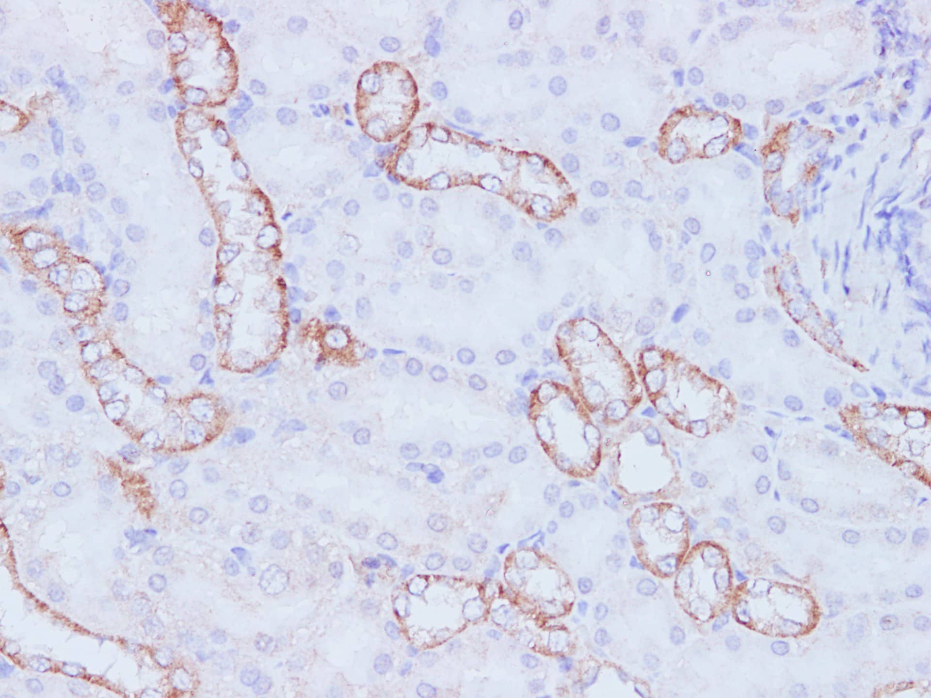 Immunohistochemistry of paraffin-embedded Rat kidney using PIK3CA Polyclonal Antibody at dilution of 1:100