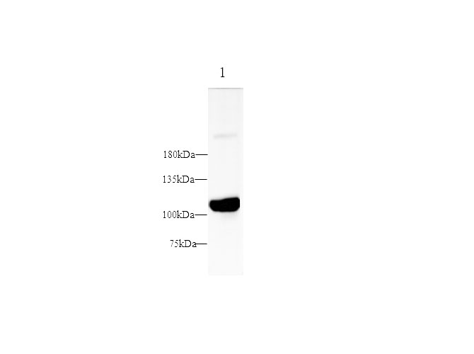 Western blot with PSMA Polyclonal Antibody at dilution of 1:1000.lane 1:LNCaP whole cell lysate