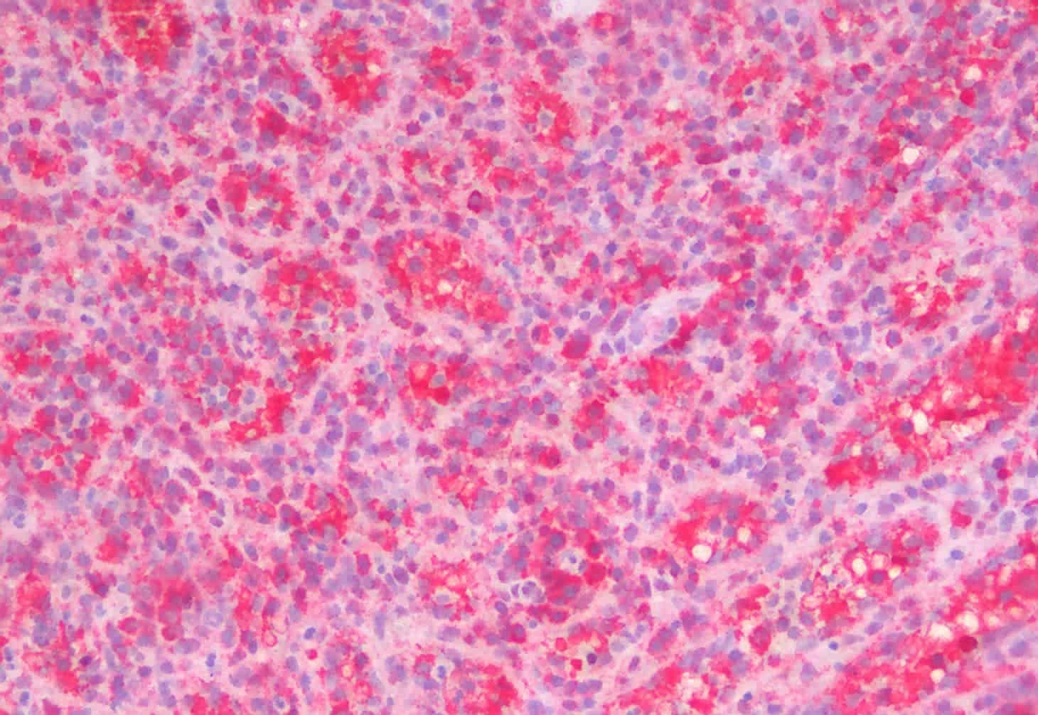 Immunohistochemistry analysis of paraffin-embedded Human Spleen using STAT1 Polyclonal Antibody.