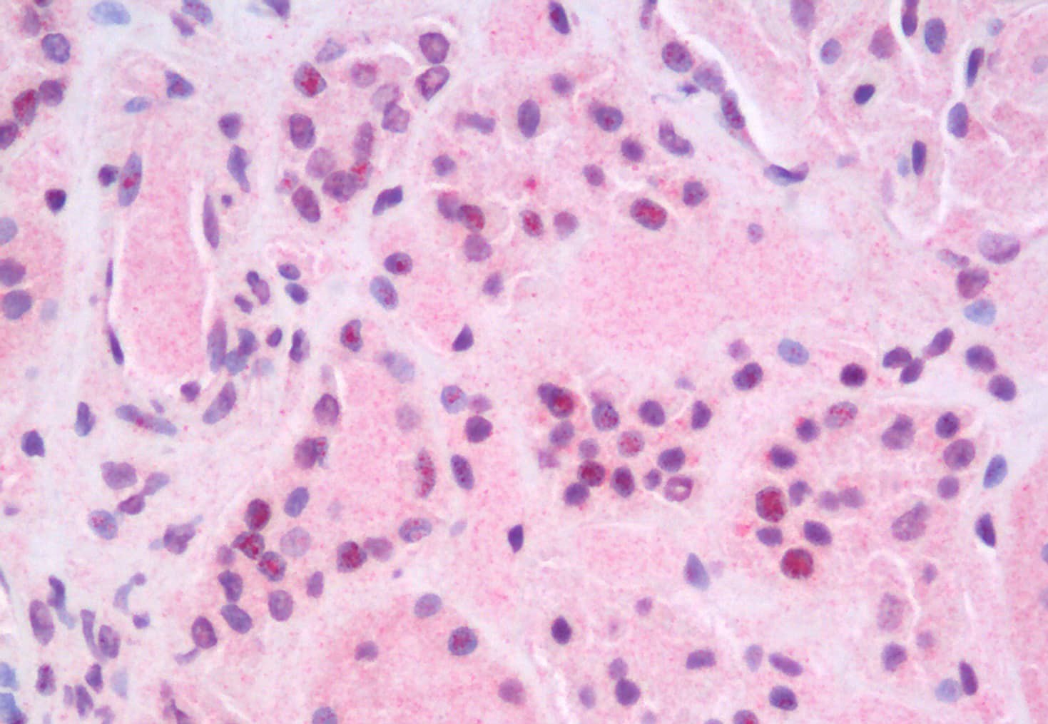 Immunohistochemistry analysis of paraffin-embedded Human Kidney using RELB Polyclonal Antibody.