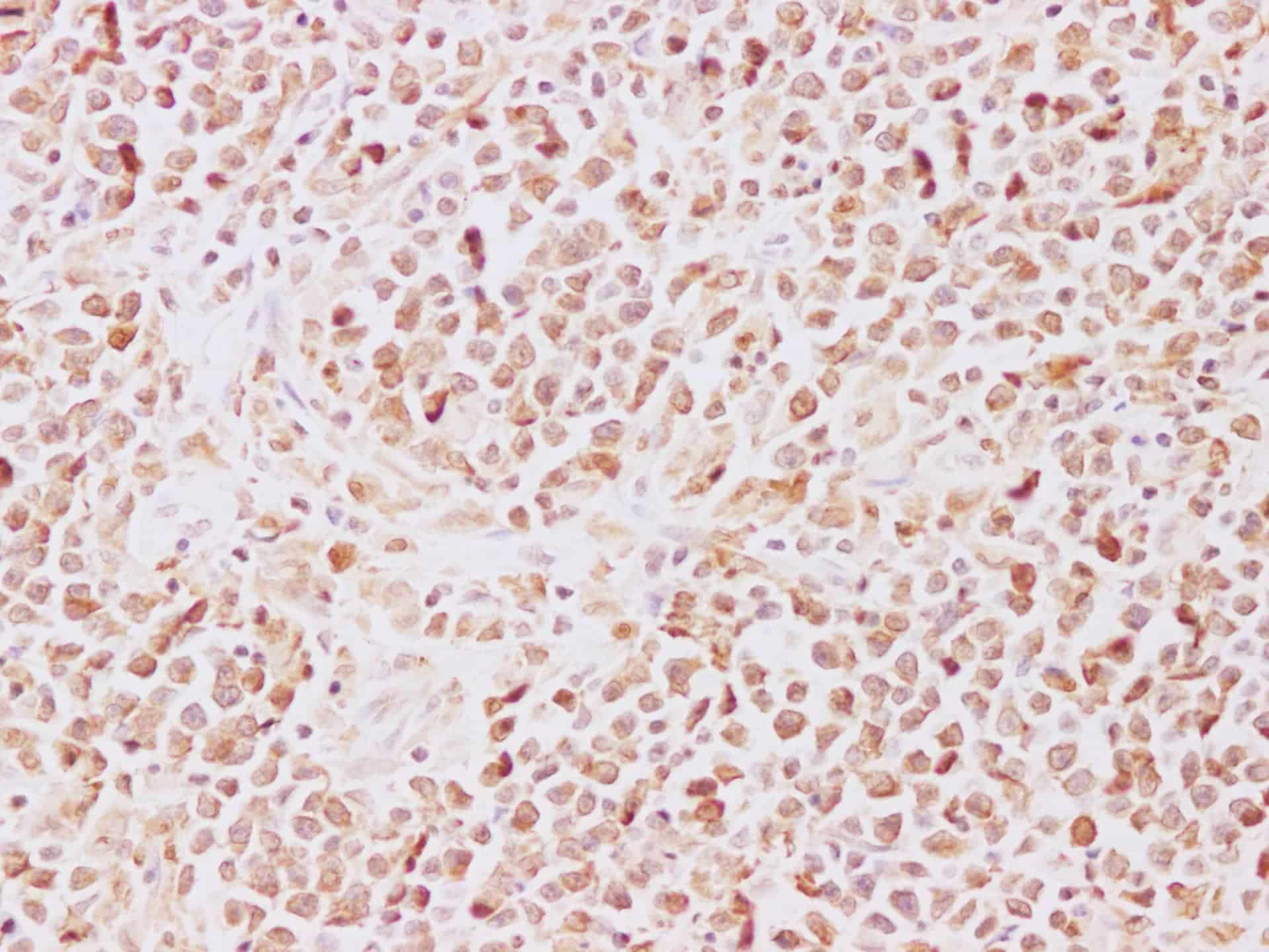 Immunohistochemistry of paraffin-embedded Human lymph node using TRAF5 Polyclonal Antibody at dilution of 1:200