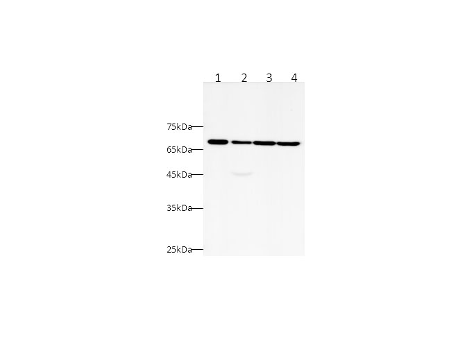 Western blot with CK5P3 Polyclonal Antibody at dilution of 1:1000.lane 1:Jurkat whole cell lysate,lane 2:Hela whole cell lysate,lane 3:A431 whole cell lysate,lane 4:HEK-293T whole cell lysate