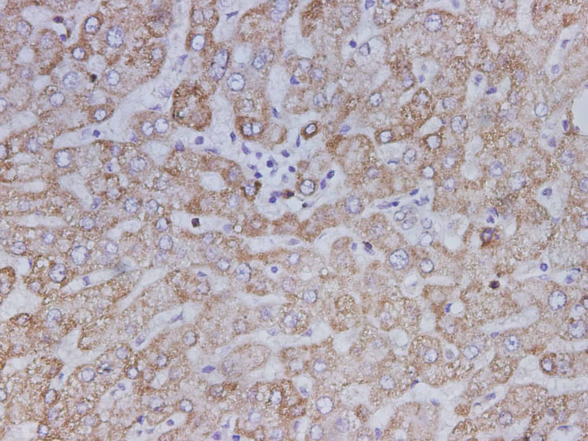 Immunohistochemistry of paraffin-embedded Human liver using SDHB Polyclonal Antibody at dilution of 1:150