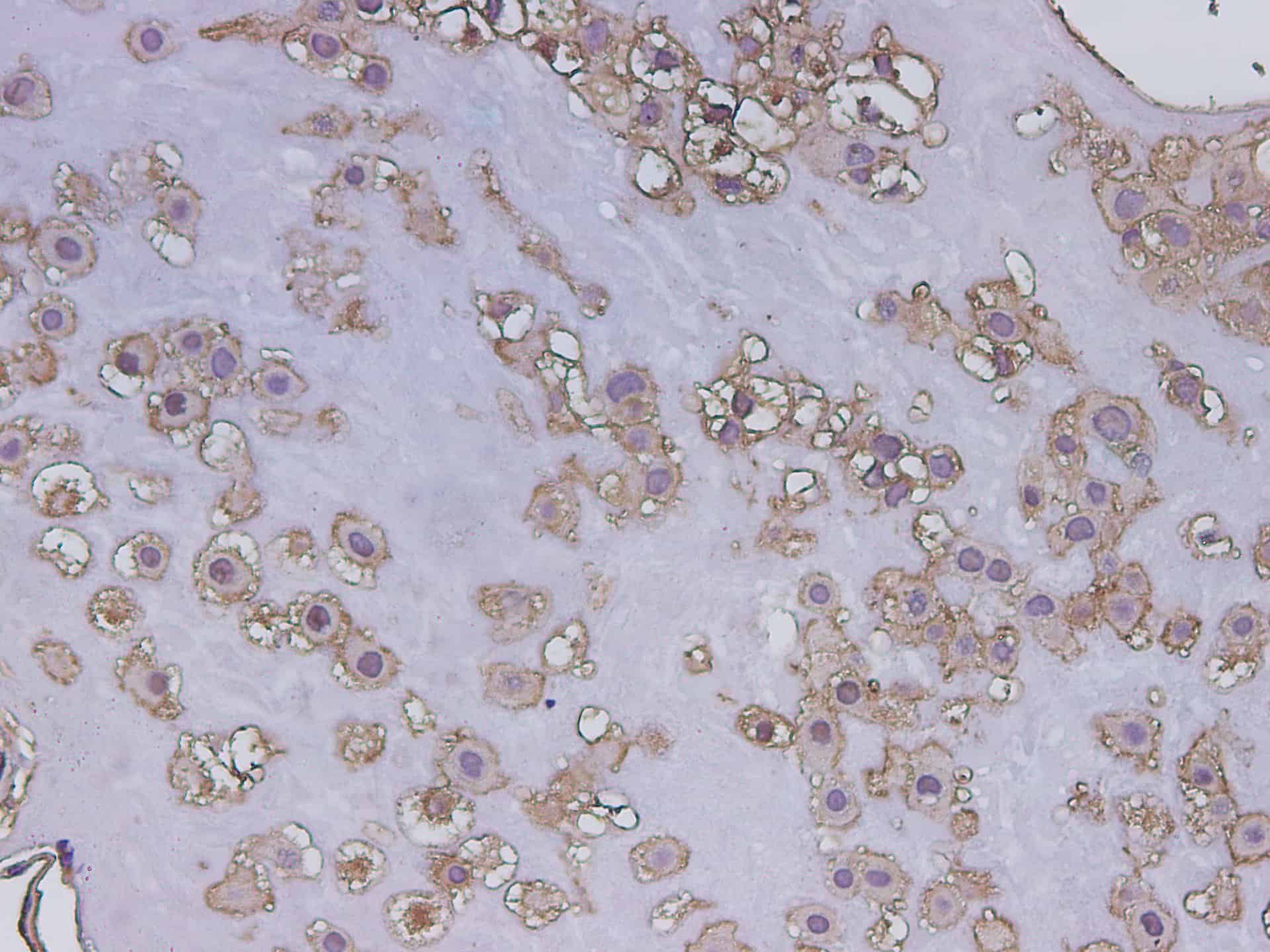 Immunohistochemistry of paraffin-embedded Human placenta using POSTN Polyclonal Antibody at dilution of 1:200