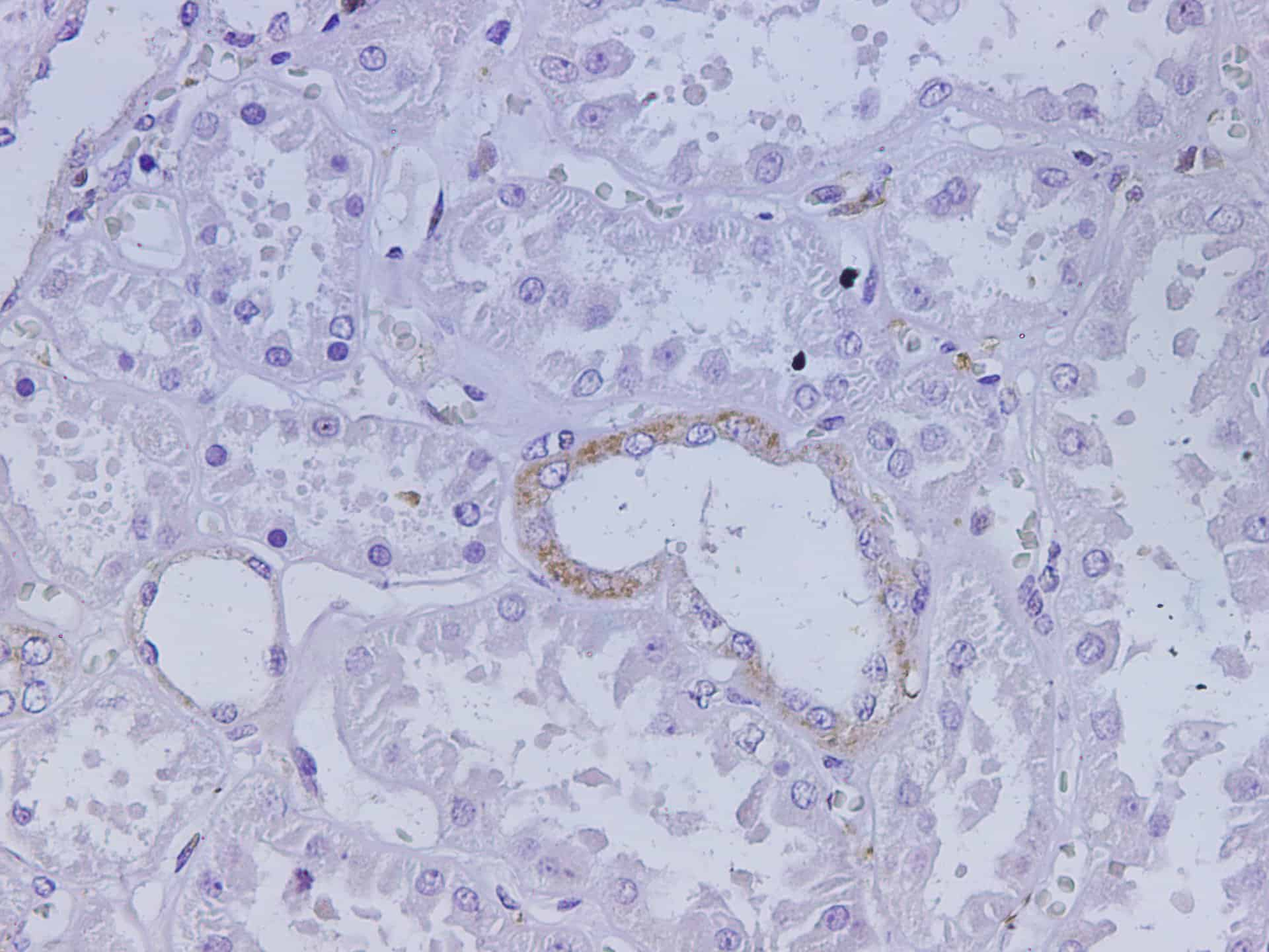 Immunohistochemistry of paraffin-embedded Human kidney using KLK2 Polyclonal Antibody at dilution of 1:2000