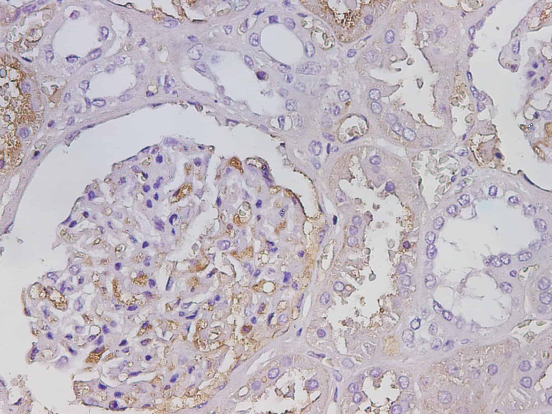 Immunohistochemistry of paraffin-embedded Human kidney using ALB Polyclonal Antibody at dilution of 1:800