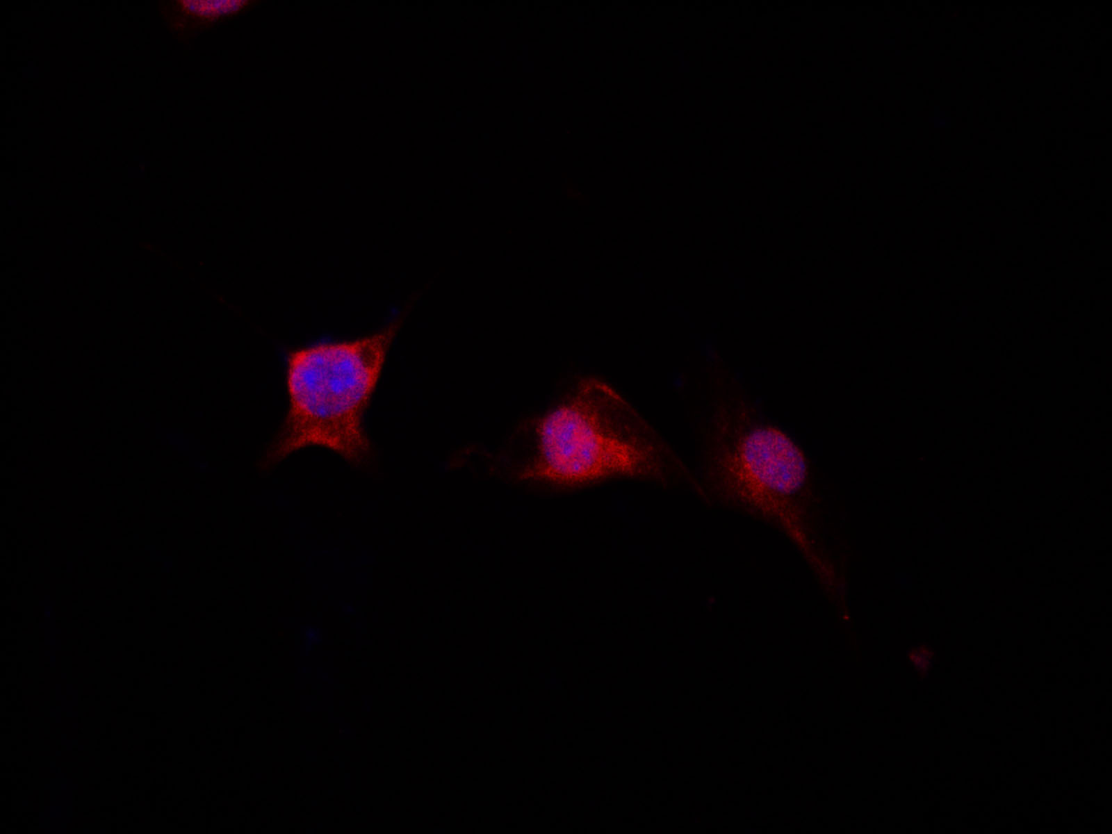 Immunofluorescence analysis of NIH-3T3 cells using GSTM1 Polyclonal Antibody at dilution of 1:200