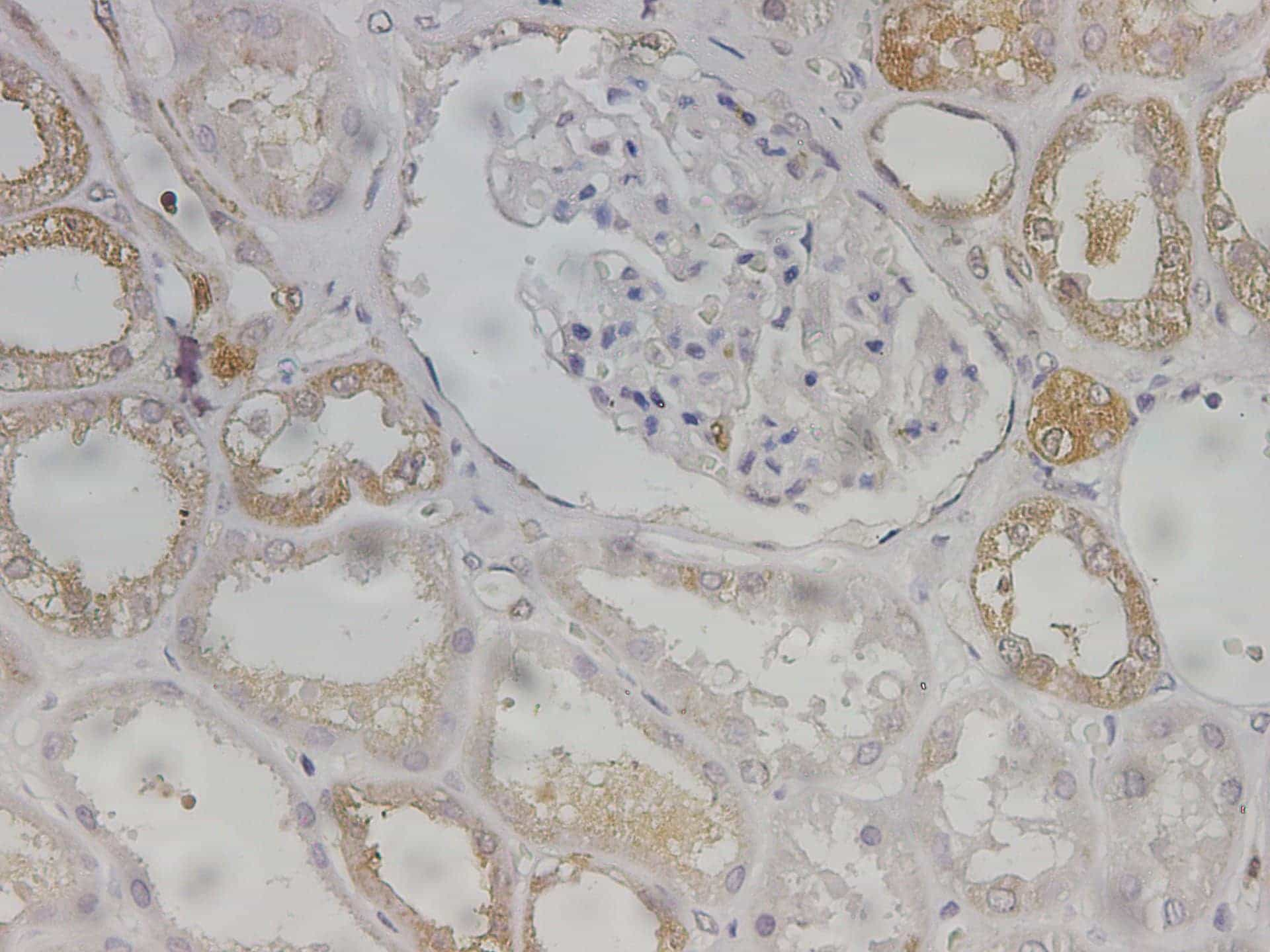 Immunohistochemistry of paraffin-embedded Human kidney using GSTM1 Polycloanl Antibody at dilution of 1:600