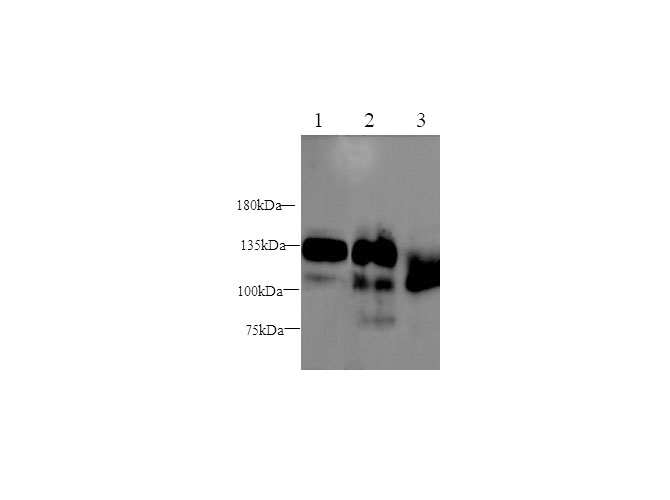 Western blot with SEMA4D Polyclonal antibody at dilution of 1:1000.lane 1:SH-SY5Y whole cell lysate,lane 2：Mouse thymus,lane 3：Rat thymus