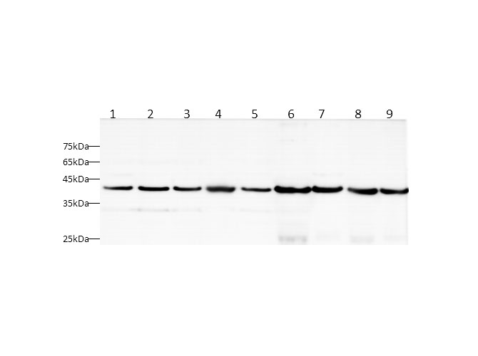 Western blot with AST Polyclonal antibody at dilution of 1:1000.lane 1:HeLa whole cell lysate,lane 2:HEK-293T whole cell lysate,lane 3:HepG2 whole cell lysate,lane 4:NIH-3T3 whole cell lysate,lane 5:C2C12 whole cell lysate,lane 6:Mouse liver,lane 7:Mouse brain,lane 8:Rat liver,lane 9:Rat brain