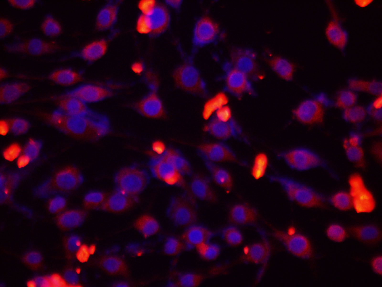 Immunofluorescence analysis of C6 cells using TTR Polyclonal Antibody at dilution of 1:200