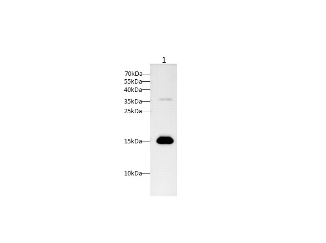 Western blot with TTR Polyclonal antibody at dilution of 1:1000.lane 1:Human plasma