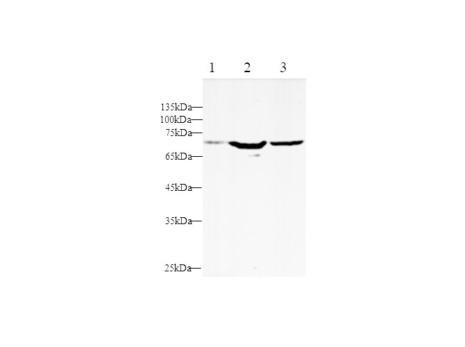 Western blot with KIM-1 Polyclonal Antibody at dilution of 1:1000.lane 1:293T whole cell lysate,lane 2:HepG2 whole cell lysate,lane 3:A549 whole cell lysate