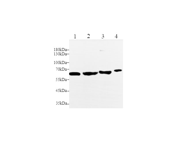 Western blot with MMP-2 Polyclonal Antibody at dilution of 1:1000.lane 1:RAW264.7 whole cell lysate,lane 2:NIH/3T3 whole cell lysate,lane 3:Mouse uterus,lane 4:Rat liver