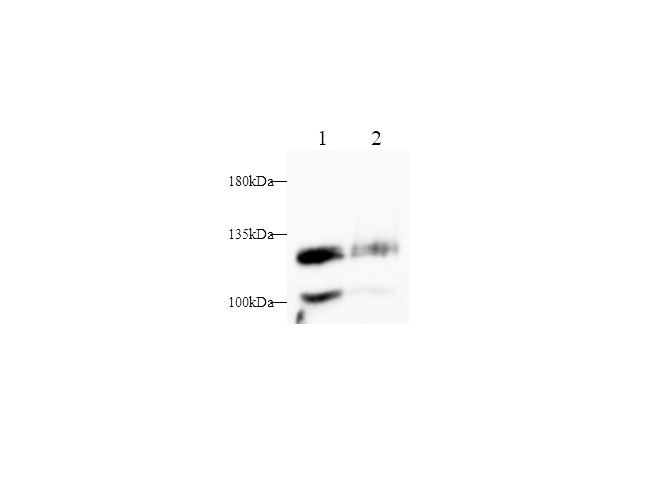 Western blot with CD146/MCAM Polyclonal antibody at dilution of 1:1000.lane 1:Hela whole cell lysate,lane 2:A375 whole cell lysate.